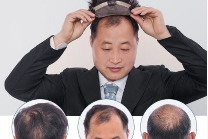 Tại sao nên sử dụng tóc giả nam Vua Tóc Giả cho người hói đầu?