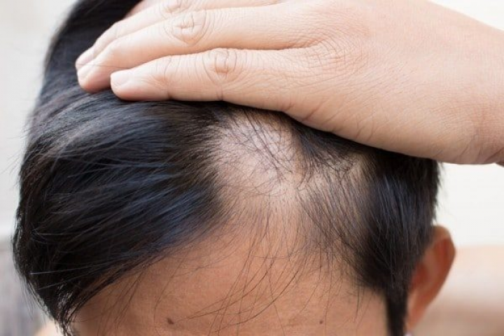 Vua Tóc Giả - Thương hiệu tóc giả ở Việt Nam uy tín, chất lượng